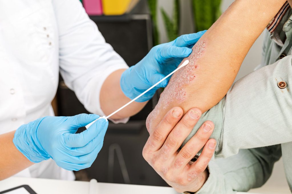 doctor taking skin sample from patient's arm