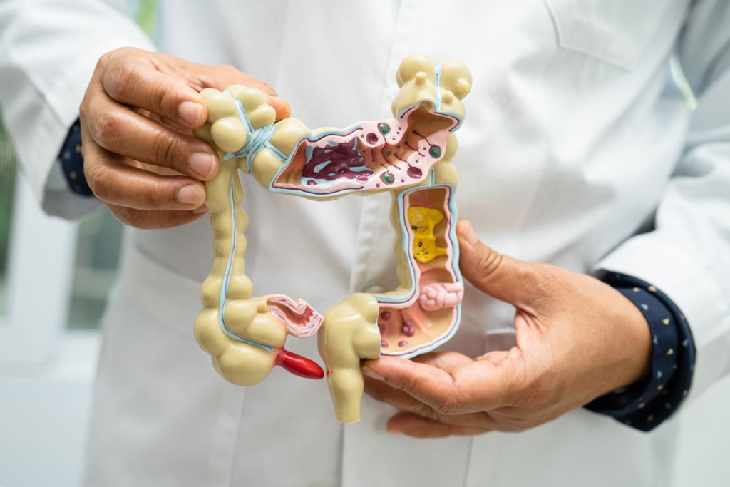 doctor holding up a model of the large intestine